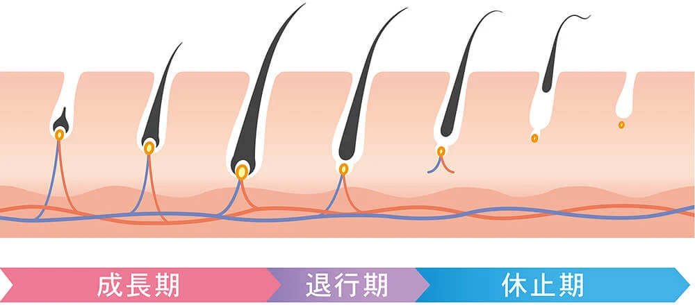 熊本県玉名市・植木町・大牟田市・山鹿市の医療脱毛でジェントルマックスプロプラスを導入している平山整形外科医院の毛周期の説明図