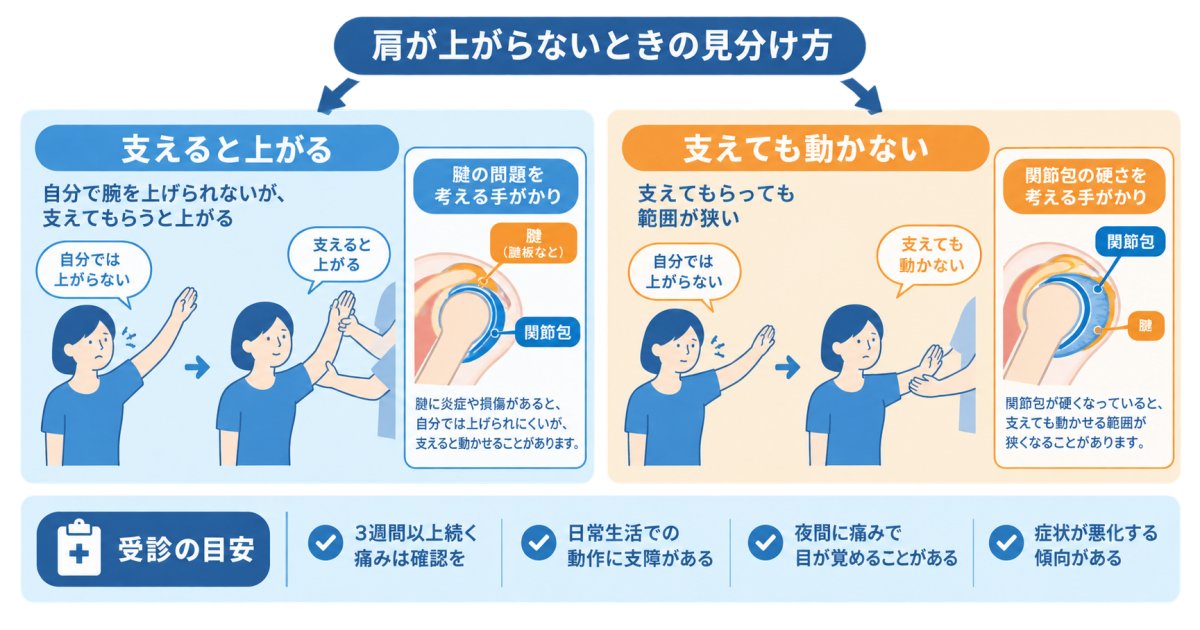 腱板断裂など似た症状との見分け方と放置のリスク