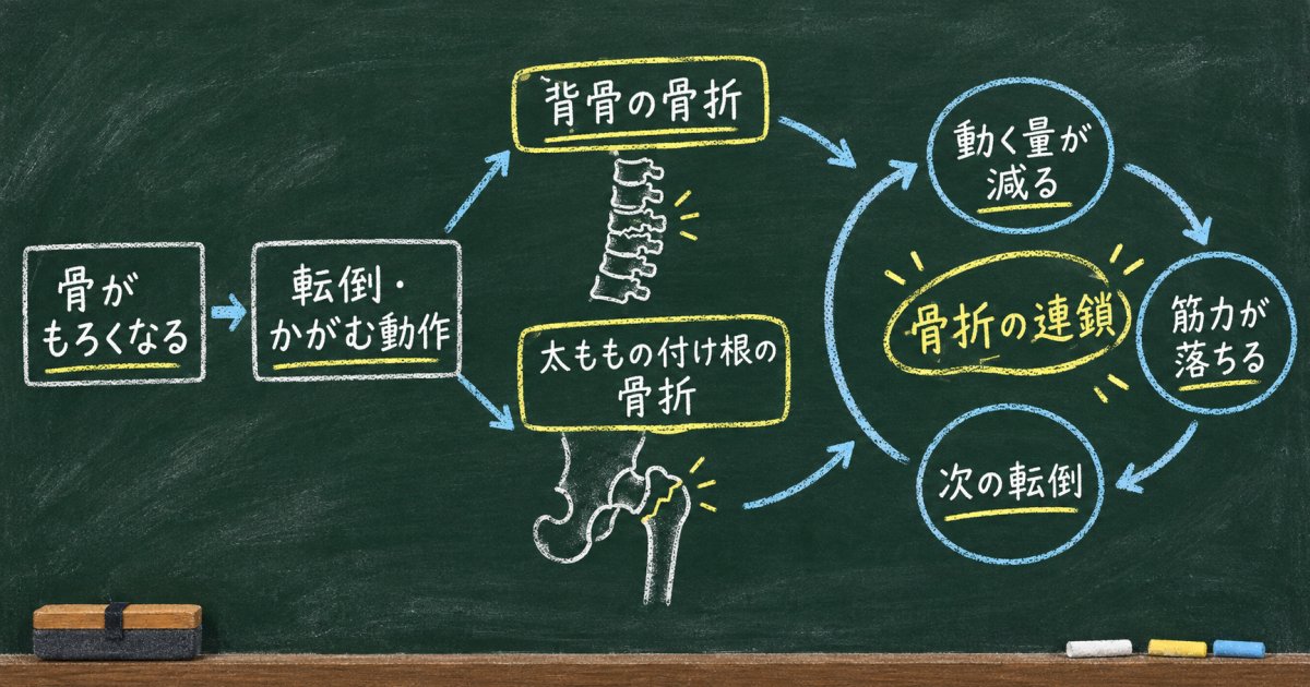 骨粗鬆症を放置すると、骨折から寝たきりにつながるのはなぜ？